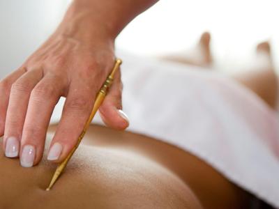 Hand führt eine Akupunkturnadel bei einer Massage in einem Wellnesshotel